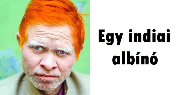 20 elképesztő véletlen, amire kisebb esély volt, mint látni egy 20 Hihetetlen véletlen, amiért kisebb esélyünk van, mint egy egyszarvút látni