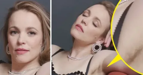Rachel McAdams megmutatta a hónaljszőrét egy fotózáson, ami vitát váltott ki