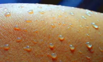 Rákos megbetegedések: Figyelmeztető tünet, melyet csak reggel észlelhetsz