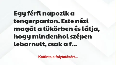 Vicc: Egy férfi napozik a tengerparton. Este nézi magát a tükörben és látja,… Vicc: Egy férfi napozik a tengerparton. Este nézi magát a tükörben és látja,…