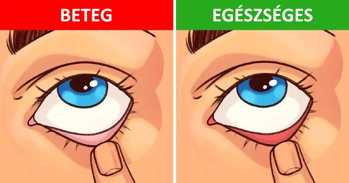 9 egyszerű teszt, melyekkel gyorsan ellenőrizheted az egészségedet 9 ötletes teszt, melyekkel gyorsan áttekintheted az egészségi állapotodat