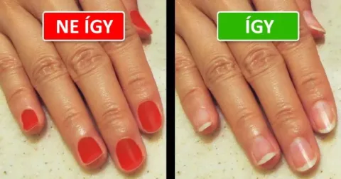 10 dolog, amivel sokat árthatsz az orvoshoz való látogatásod során