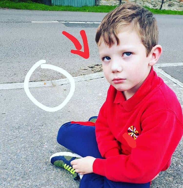 lóganéba ejtett nyalóka