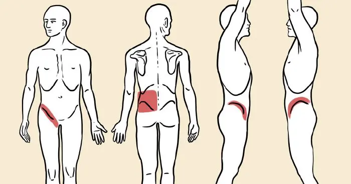 5 vesekőre figyelmeztető jel, amire emlékezni kell