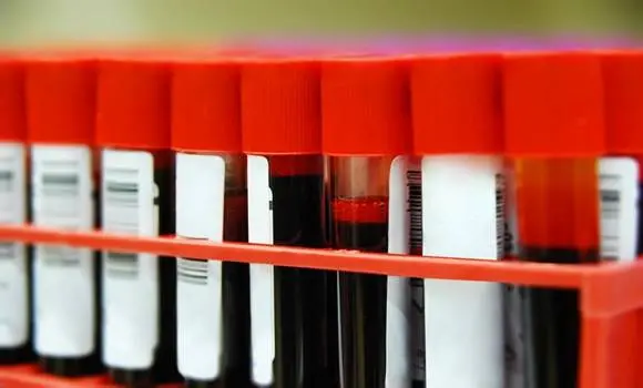 Most derült ki a 0-s vércsoportú emberekről A 0-s vércsoport titkainak felfedezése