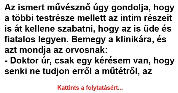 Vicc: Az ismert művésznő úgy gondolja Vicc: Az ismert művésznő úgy gondolja