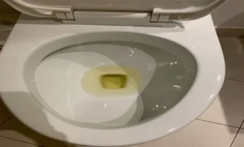 Ha így pisilsz, a rák egyik tünete is lehet Pisilés közbeni vér megjelenése: egy fontos figyelmeztető jel a rákról