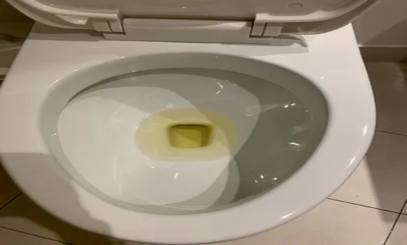 Ha így pisilsz, a rák egyik tünete is lehet Pisilés közbeni vér megjelenése: egy fontos figyelmeztető jel a rákról