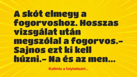 Vicc: A skót elmegy a fogorvoshoz. Hosszas vizsgálat után megszólal a…