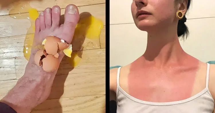 10+ alkalom, mikor a balszerencse közbelépett, hogy próbára tegye az... 10+ eset, amikor a szerencsétlenség az emberre nevet – Vigasztaljon örökké tartó mosollyal!
