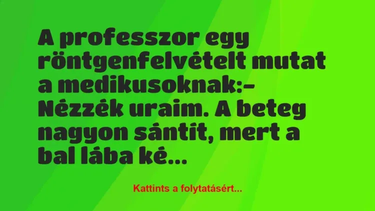 Vicc: A professzor egy röntgenfelvételt mutat a medikusoknak:
– Nézzék… Vicc: A professzor egy röntgenfelvételt mutat a medikusoknak:
– Nézzék…