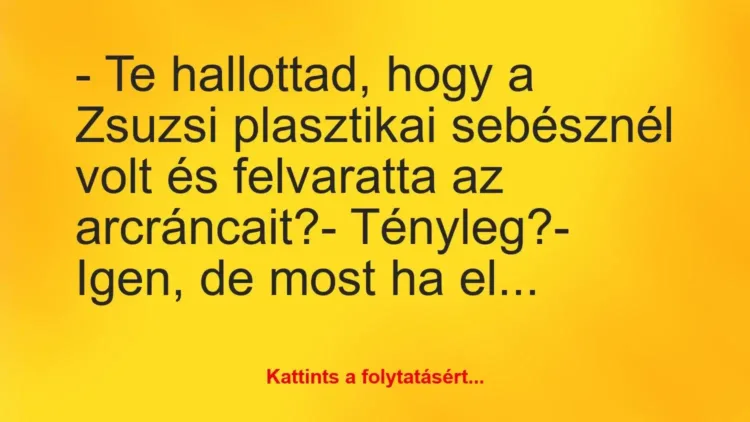 Vicc: – Te hallottad, hogy a Zsuzsi plasztikai sebésznél volt és felvaratta… Vicc: – Te hallottad, hogy a Zsuzsi plasztikai sebésznél volt és felvaratta…