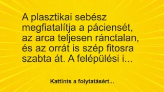Vicc: A plasztikai sebész megfiatalítja a páciensét