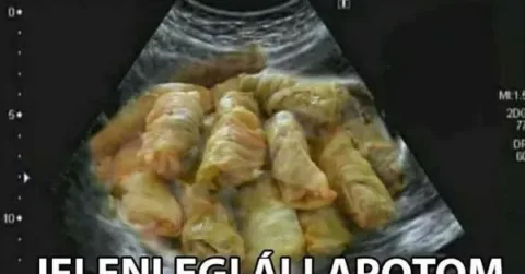 Vicc: Jelenlegi állapotom
