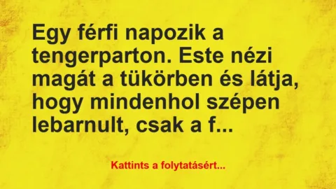 Vicc: Egy férfi napozik a tengerparton. Este nézi magát a tükörben… Vicc: Egy férfi napozik a tengerparton. Este nézi magát a tükörben…