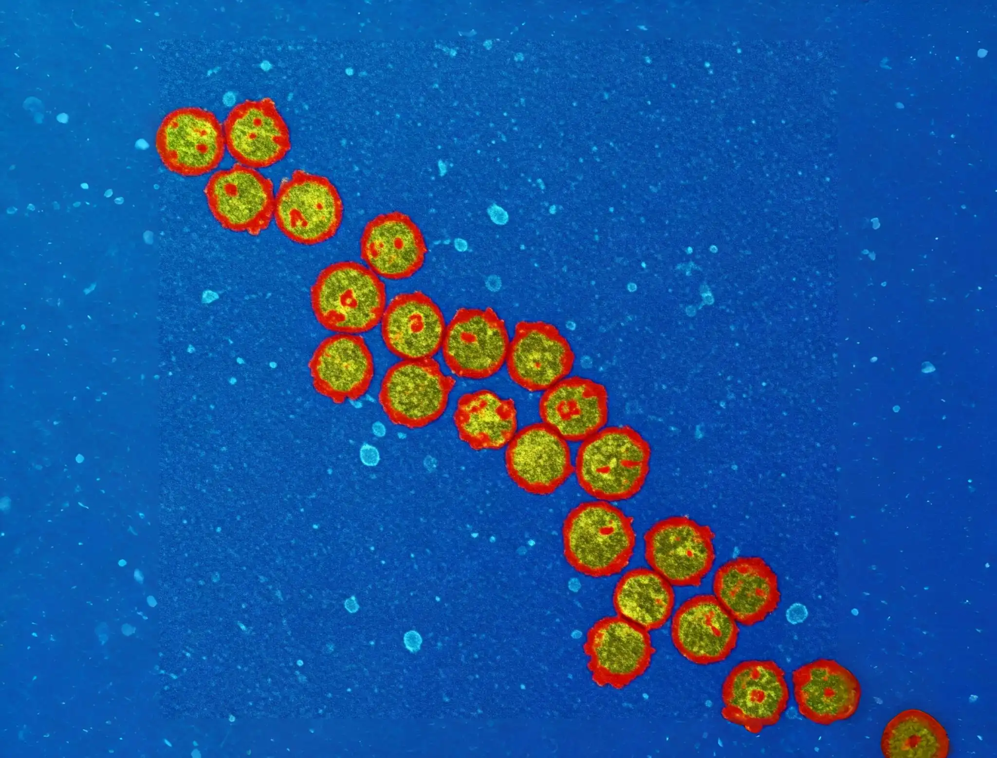 beleegyezés, HeLa, kísérlet, orvosietika, rák, rákkutatás, sejtek, történelem, tudomány, visszaélés