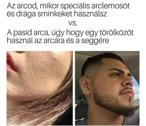 Az arcod, mikor speciális arclemosót és drága sminkeket használsz...