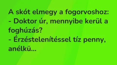 Vicc: A skót elmegy a fogorvoshoz:

– Doktor úr, mennyibe kerül a foghúzás?

-…