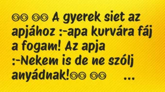 Viccek:
A gyerek siet az apjához :-apa kurvára fáj a … Viccek:
A gyerek siet az apjához :-apa kurvára fáj a …