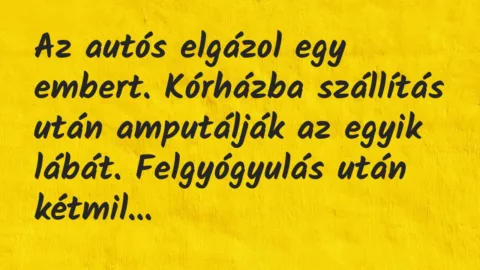 Vicc: Az autós elgázol egy embert. Kórházba szállítás után amputálják az egy…