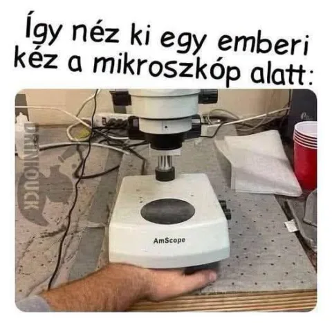 Így néz ki egy emberi kéz a mikroszkóp alatt?