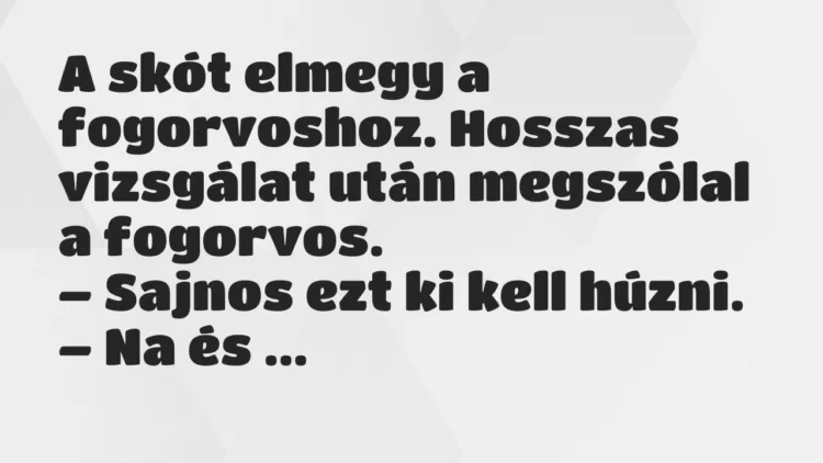 Vicc: A skót elmegy a fogorvoshoz. Hosszas vizsgálat után megszólal… Vicc: A skót elmegy a fogorvoshoz. Hosszas vizsgálat után megszólal…