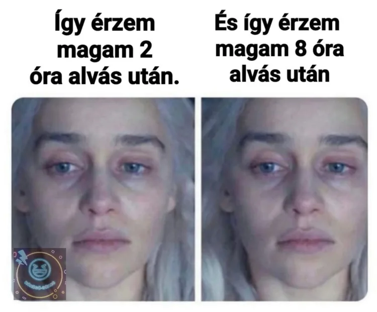 Így érzem magam 2 óra alvás után... Így érzem magam 2 óra alvás után...