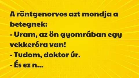 Vicc: A röntgenorvos azt mondja a betegnek…